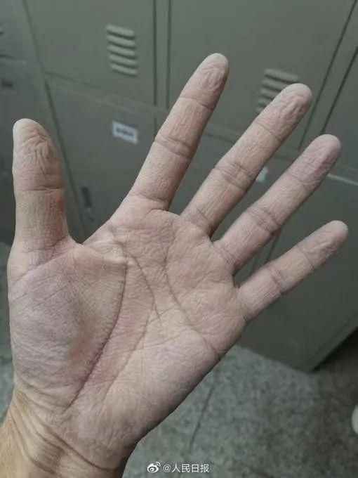 这些战“疫”瞬间,让我们坚信终将春暖花开