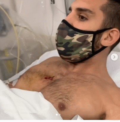 被送进医院的卡内蒂。 MMA选手实战能力有多强?这群倒霉劫匪最清楚…