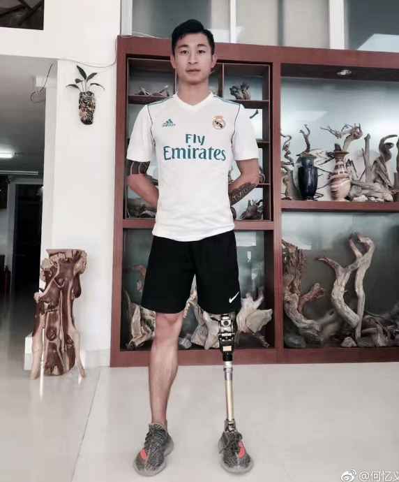 何忆义社交媒体截图。 他没左腿,有人不愿和他踢球,但他仍想在绿茵